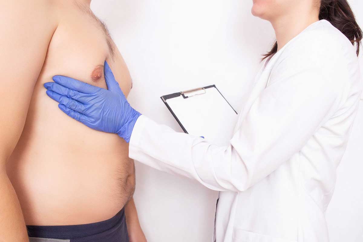 Gynecomastia
