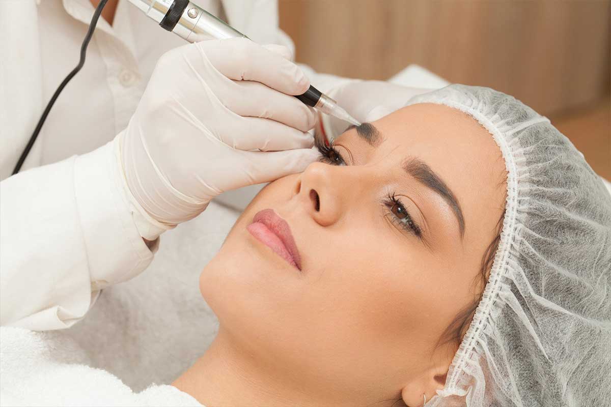 Eyebrow Transplant