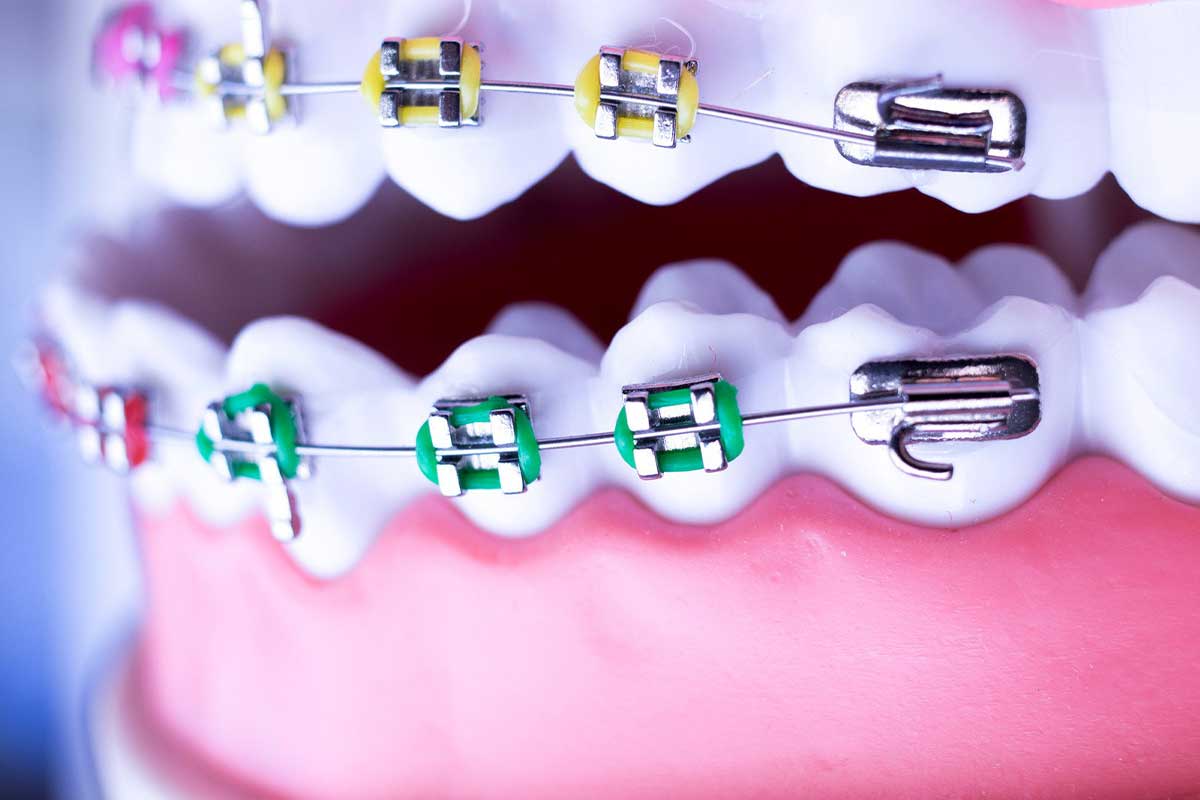 Orthodontic Applications